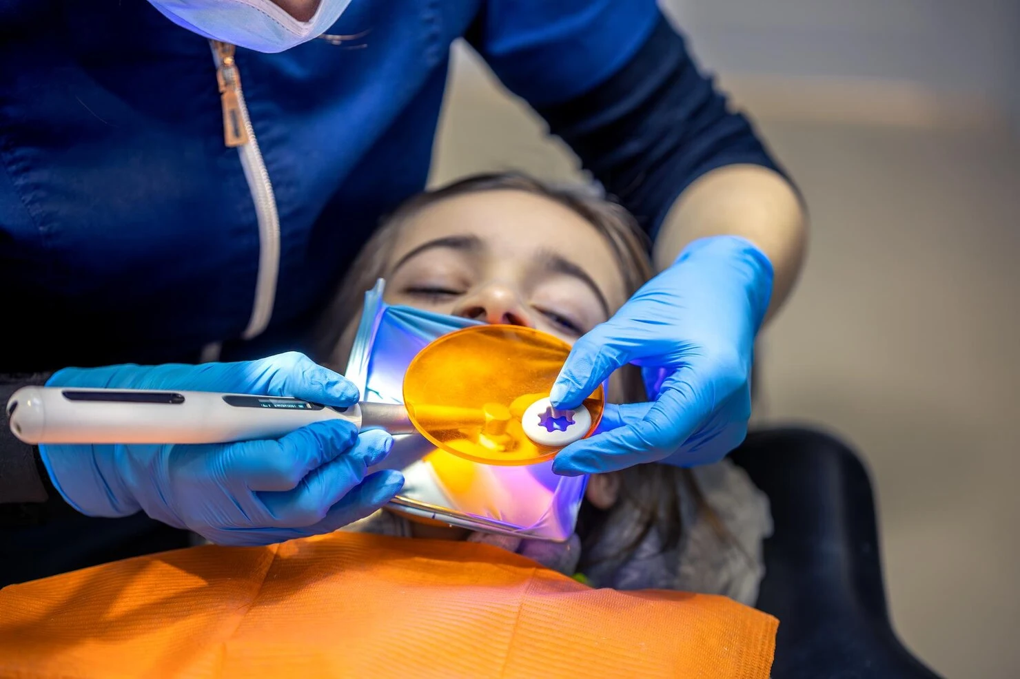 ROOT CANAL PROCESS2