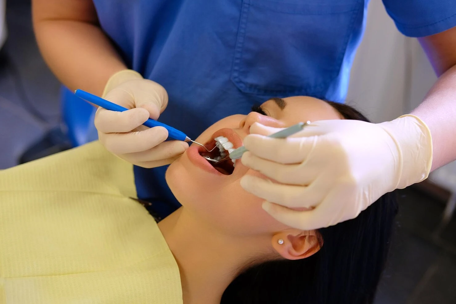 ROOT CANAL PROCESS1