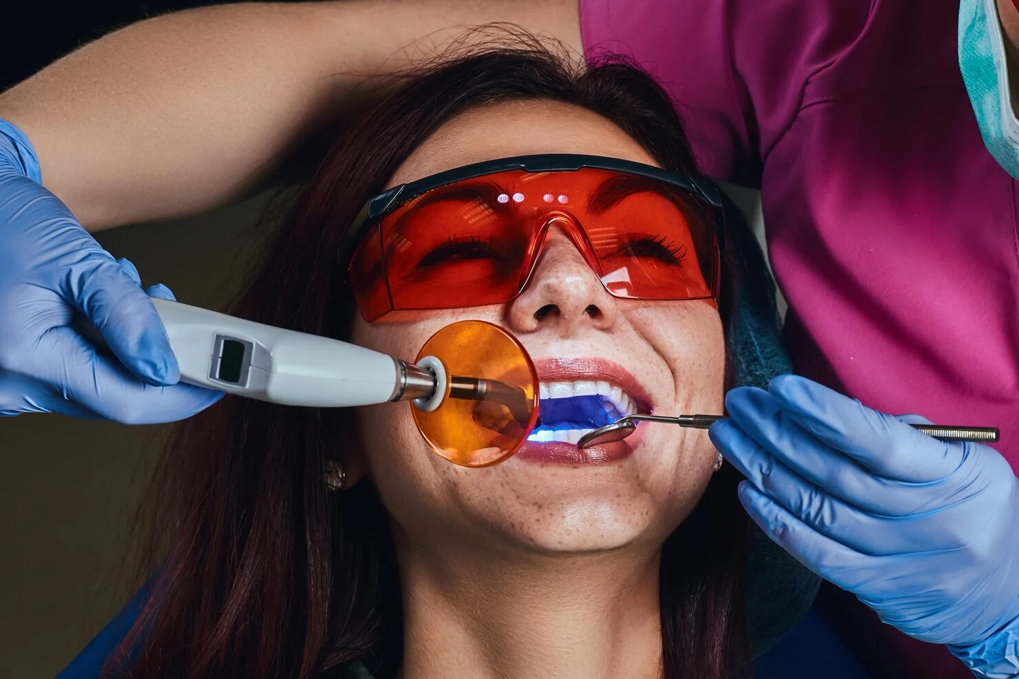whitening costs