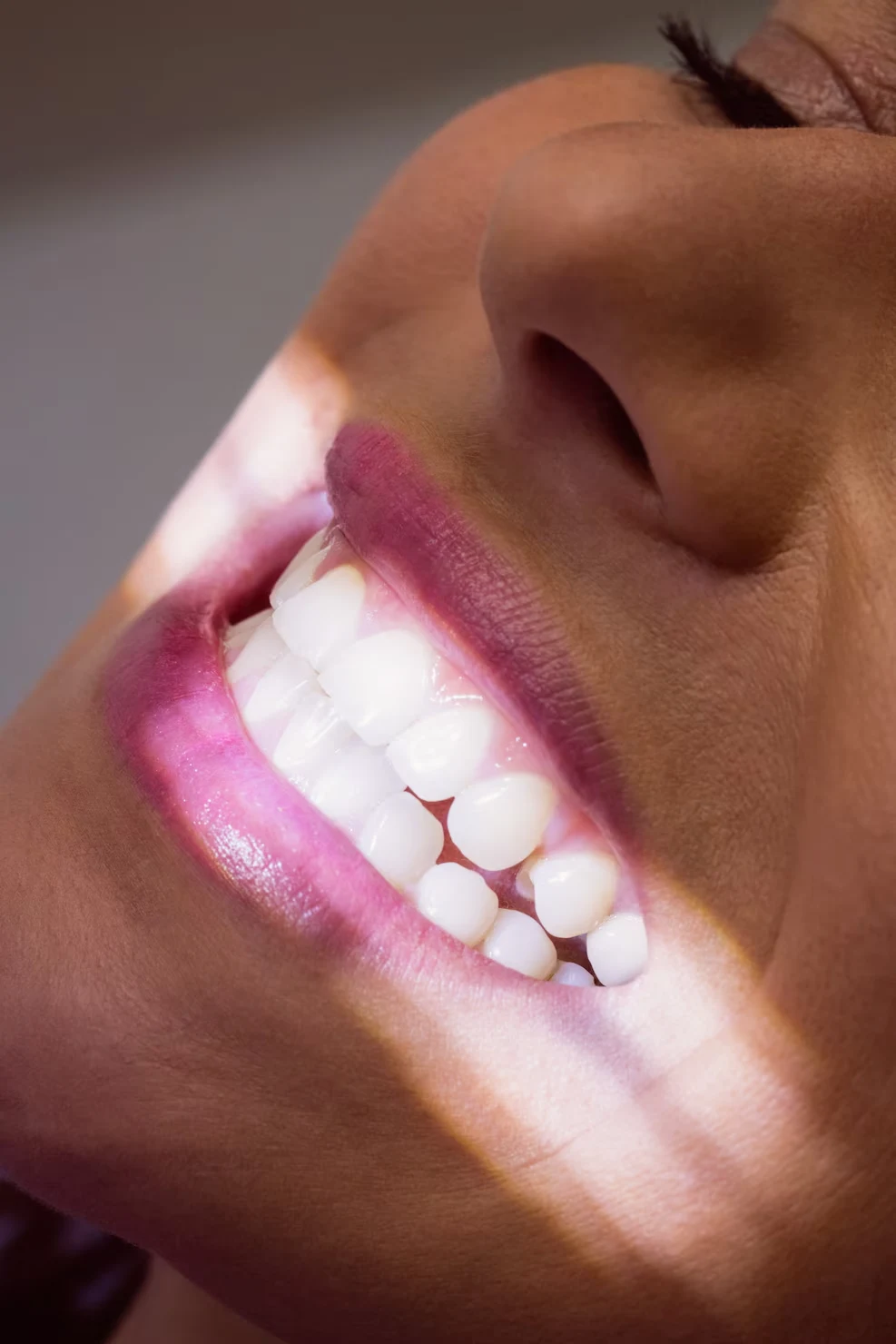 Our teeth whitening