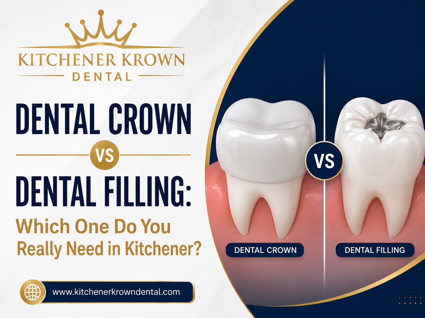 Dental Crown