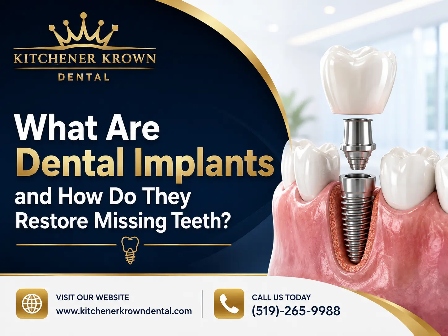 dental imlant kitchener